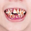 Dents De Zombie Dental FX