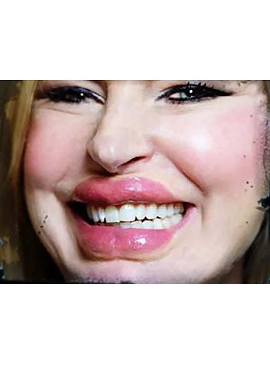 Lèvres Botoxées 3D FX Transfers – Image 2